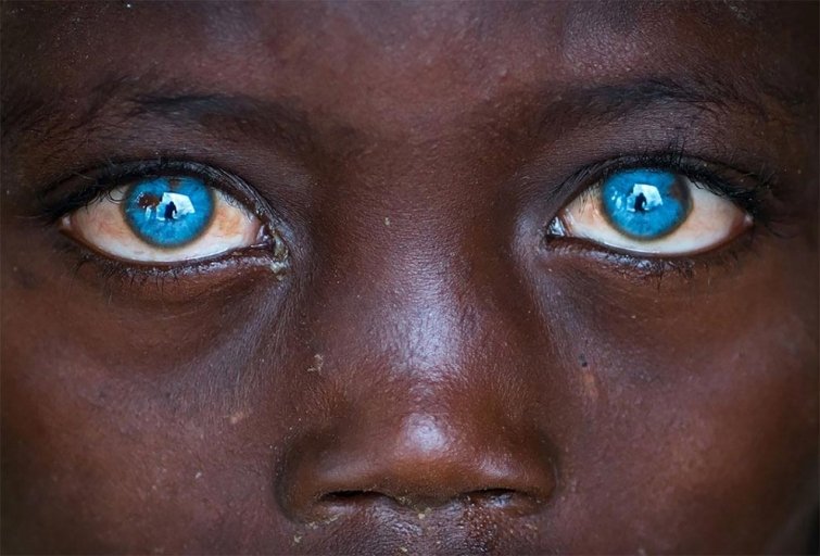Цэнхэр нүдтэй африк хүү