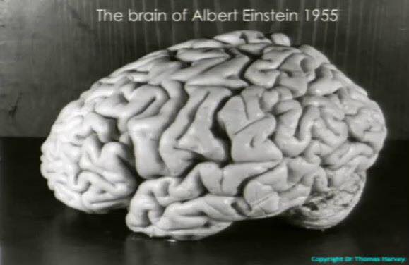 Эйнштэйнийг нас барсны дараа түүний тархийг судалж үзэхэд олон сонирхолтой зүйлсийг илрүүлжээ 
